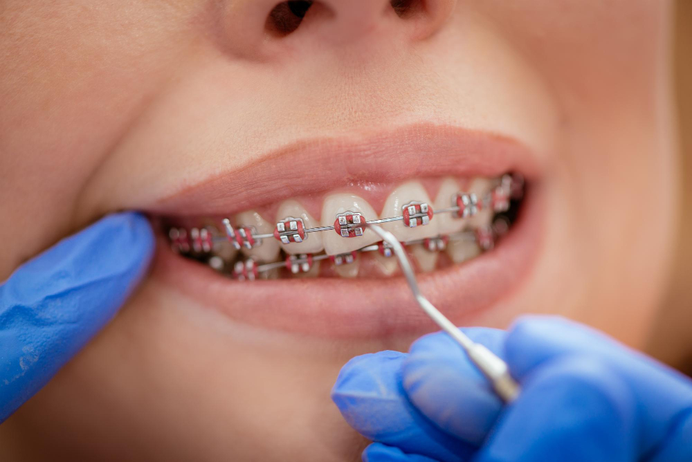 Orthodontics